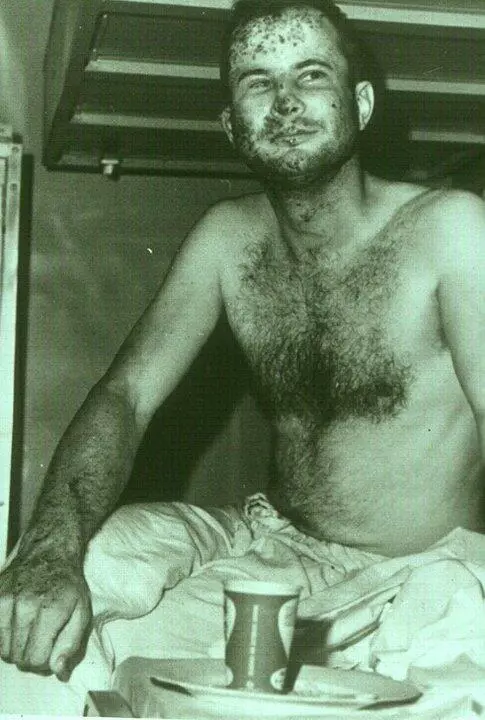Injured sailor